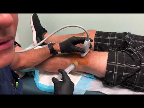MoraMD: Platelet Rich Plasma (PRP) for Knee Arthritis: Live injection with Dr Steve Mora