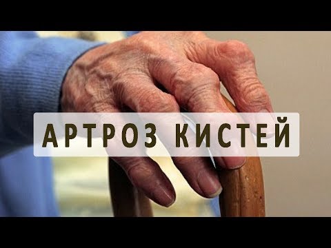 Привычный вывих коленного сустава лечение Боли под ложечкой и спине причина