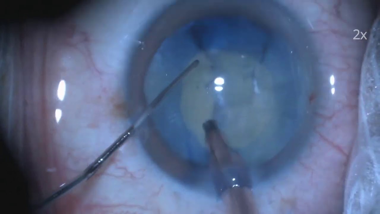 Julio César Moreno Nava-21