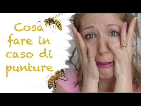 Come rafforzare lesercizio legamenti e articolazioni Articolazioni metacarpo della struttura
