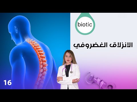 فيديو | الانزلاق الغضروفي - العقم - خلطات العناية بالبشرة - م٤ Biotic - الحلقة ١٦