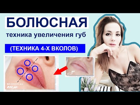 Болюсная техника / Техника 4-х вколов УВЕЛИЧЕНИЯ ГУБ
