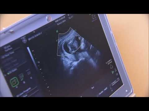 Pregnant Women And Children Conference