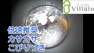 耳掃除動画vol.75「倍速推奨　カサカサこびりつき」