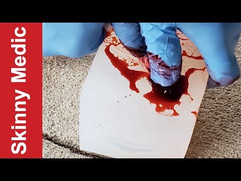 Phokus Research Group Wound Cube