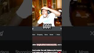 Kai Cenat Looked Up His Symptoms On Google! 😭💀