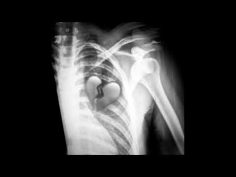 CHXNNER x BABY G - Why do u luv me back Audio. (Prod.Yung Skio)