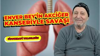 4. Evre Akciğer Kanseri ve Beyin Metastazı Hasta Hikayesi | Dr. Hakan Özkul Fitoterapi Desteği videosu
