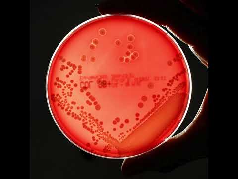 Pipeline of new drugs to fight superbugs is 'worryingly thin.