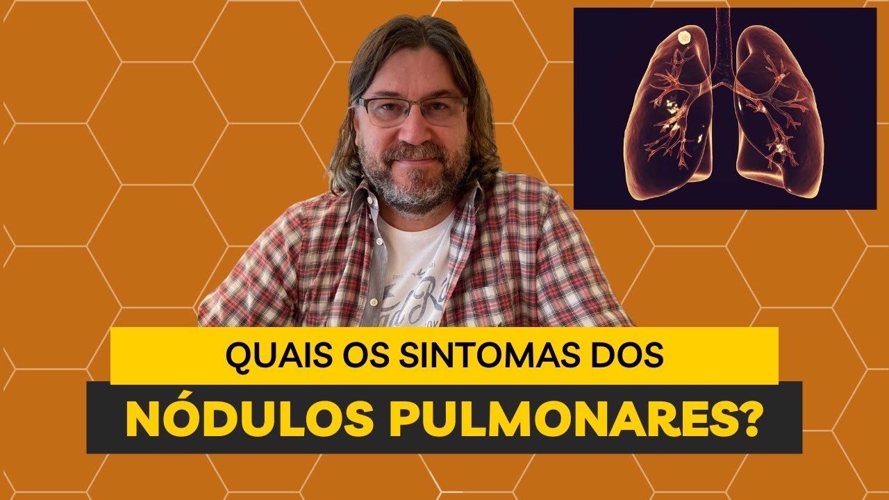 Nodulo pulmonar: quais são os sintomas?