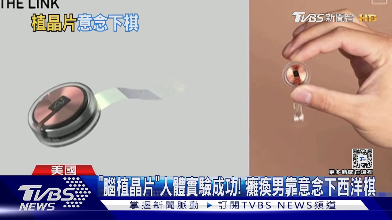 「腦植晶片」人體實驗成功! 癱瘓男靠意念下西洋棋