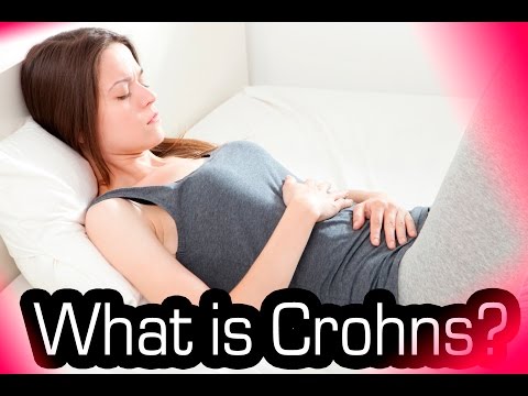 What Is Crohns Disease?????