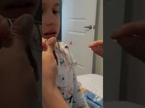 Como sacar Facil y Rapido un diente de Leche 🦷 #smile #viralvideo #shorts #reels #teeth