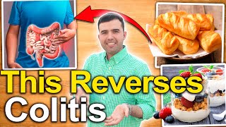 How to Treat Ulcerative Colitis? - Foods and Natural Remedies to Cure Ulcers in the Colon