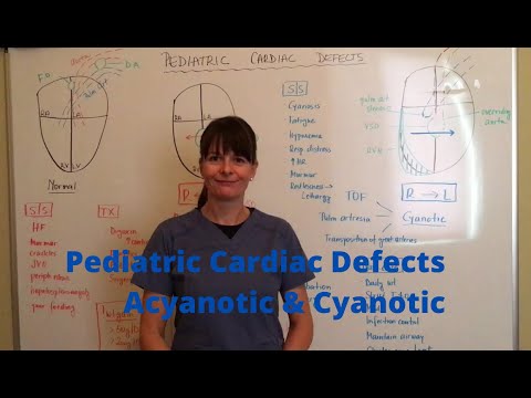 Pediatric cardiac defects - Acyanotic & Cyanotic