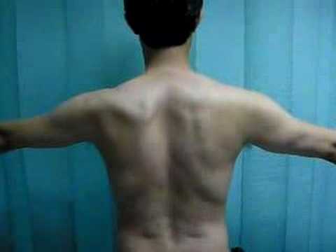 Motion Between Scapula And Thorax