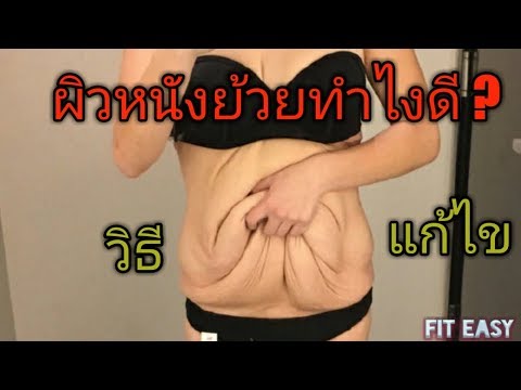 โรคผิวหนังและกลากในตับอ่อน โรคสะเก็ดเงินอิสลาม