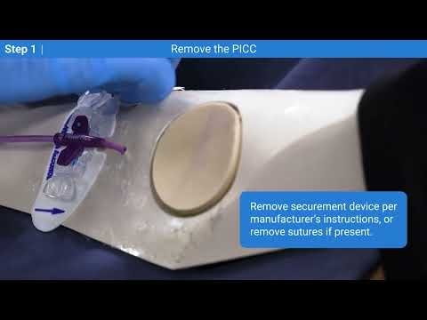 How to Remove PICC Line: Step 1 - Lisa A. Gorski | Medbridge
