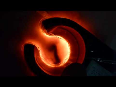 Sclerotherapy with VeinLite LEDX Skin Transilluminator