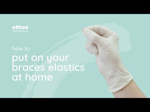 How To Put On Braces Elastics At Home | Braces Tips