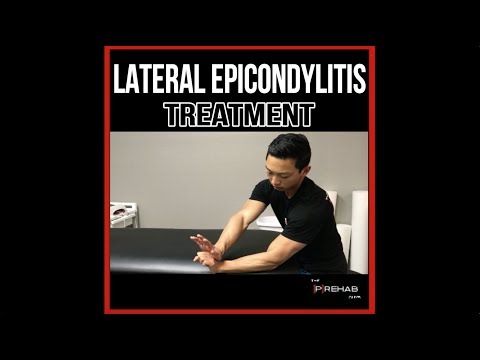 könyökízület epicondylitis kezelési áttekintése