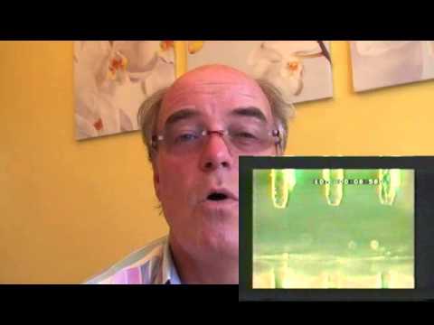 Solder Balling Defect and How to Avoid Them by Bob Willis