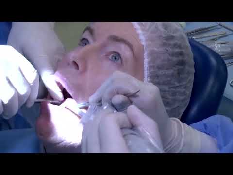 UK dental system pushes patients to seek treatment abroad | Reuters