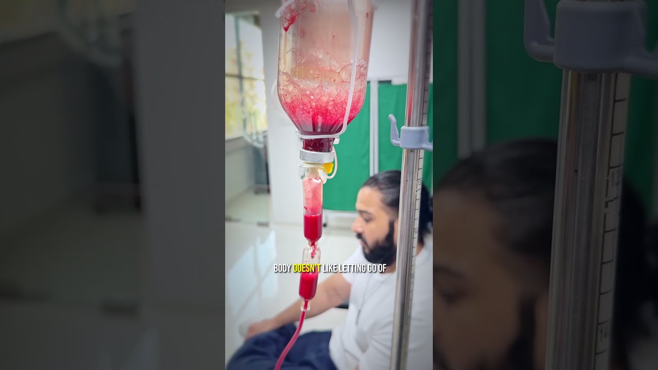 Ozone Therapy for Weight Loss Plateau — Weight Loss & Metabolic patient testimonial at Clinic Living Plus, Bengaluru