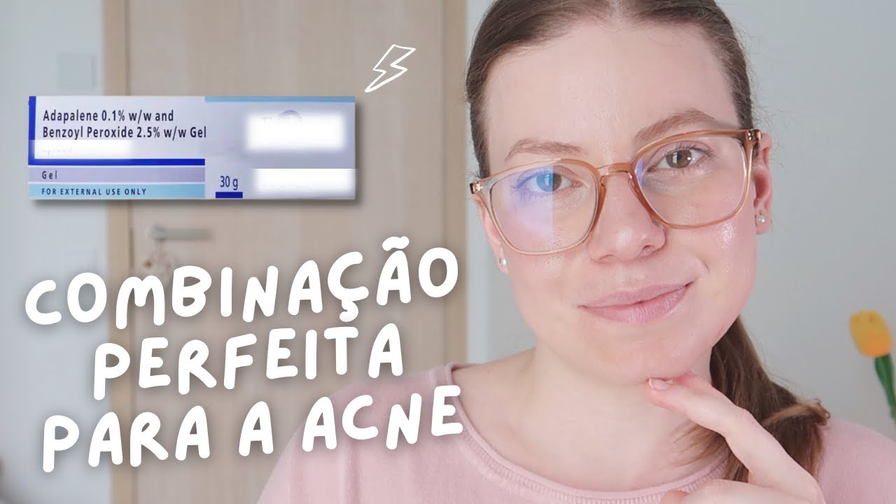Adapaleno + Peróxido de Benzoíla: TUDO o que você precisa saber sobre esse tratamento para a acne