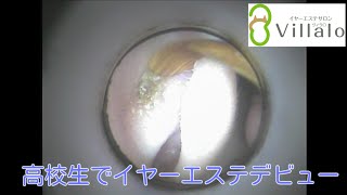 耳掃除動画vol.25「高校生でイヤーエステデビュー」