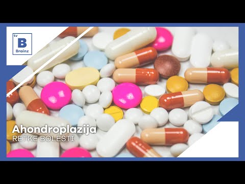 Retke bolesti - Ahondroplazija