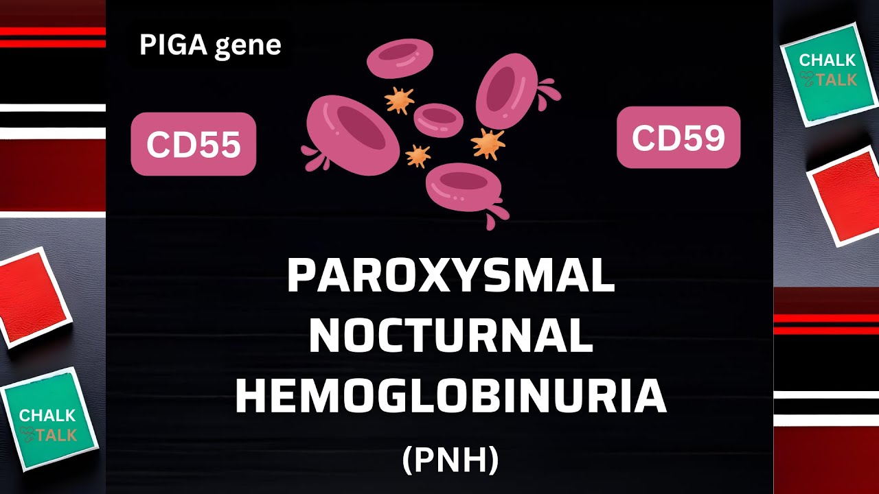 Paroxysmal Nocturnal Hemoglobinuria. Understanding PNH.