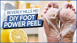 How To Make DIY Foot "Power Peel" (Easy to make!) | Beverly Hills MD Beauty Tips