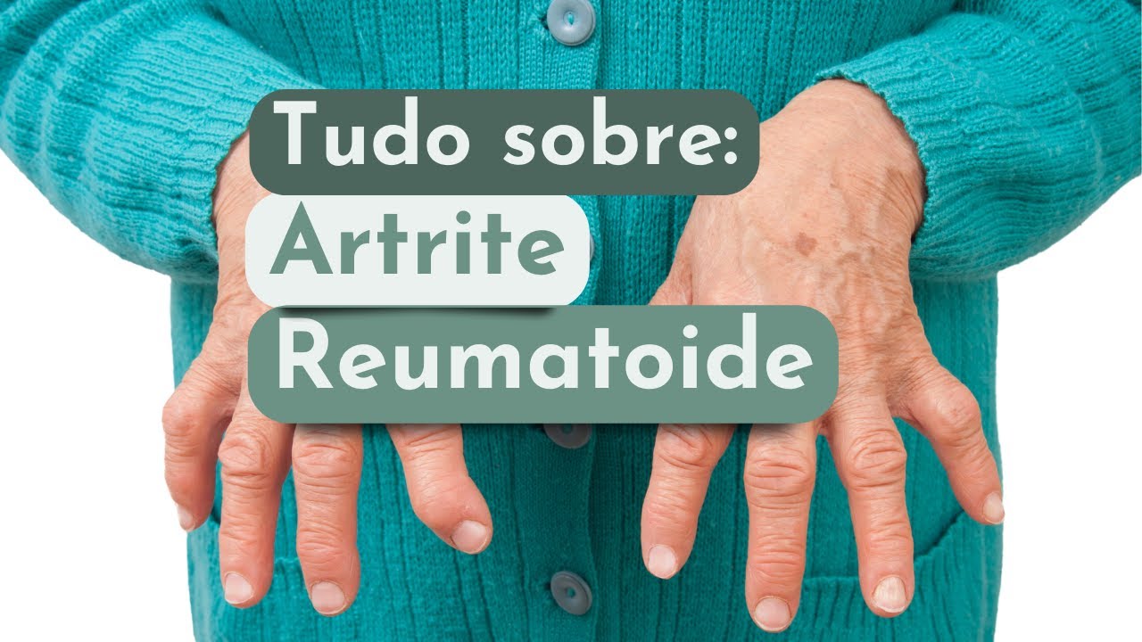 Tudo sobre Artrite Reumatóide