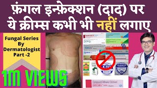 Ringworm Fungal Infection Treatment In Hindi | Fungal Infection Cream Without Steroids | Dr Sunil