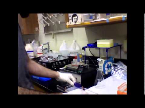 Purified plasmid suspension run on 1.2% agarose gel (FGF4)