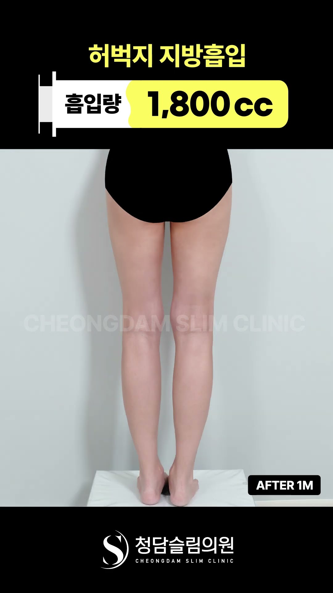 다리선 차이 꽤 큰데? 👀