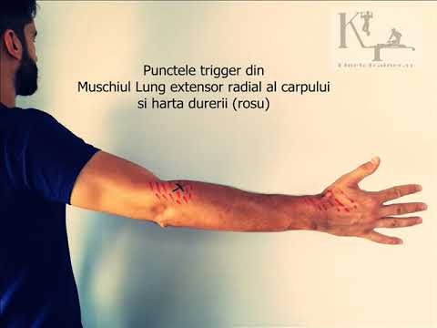 Artroza artrita articulațiilor degetelor