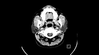 Case of the Day - 28 Nov 24
