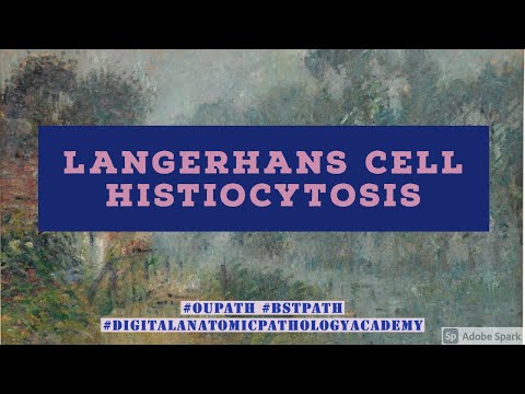 Langerhans Cell Histiocytosis
