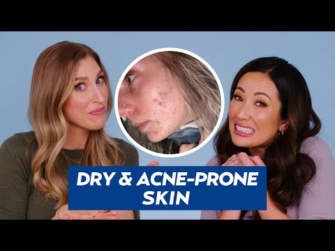 Acne-Prone, Dry Skin Skincare Routine for Nicole! | DERMATOLOGIST REACTS
