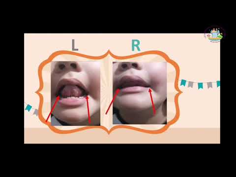 "Fonema /r/ parte 1"