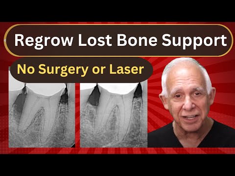 How to Reverse Bone Loss from Gum Disease Without Surgery
