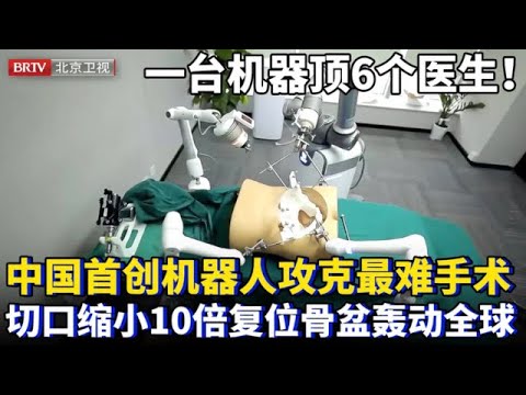 一台机器顶6个医生！中国首创机器人攻克骨盆最难手术，仅需几个孔洞复位骨盆，切口缩小10倍还零误差，轰动全球医疗界！【为你喝彩】