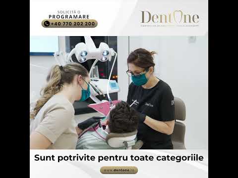 Alignere ortodontice – tratament modern pentru îndreptarea dinților