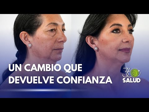 UN CAMBIO INTEGRAL: MÁS ALLÁ DE LO ESTÉTICO
