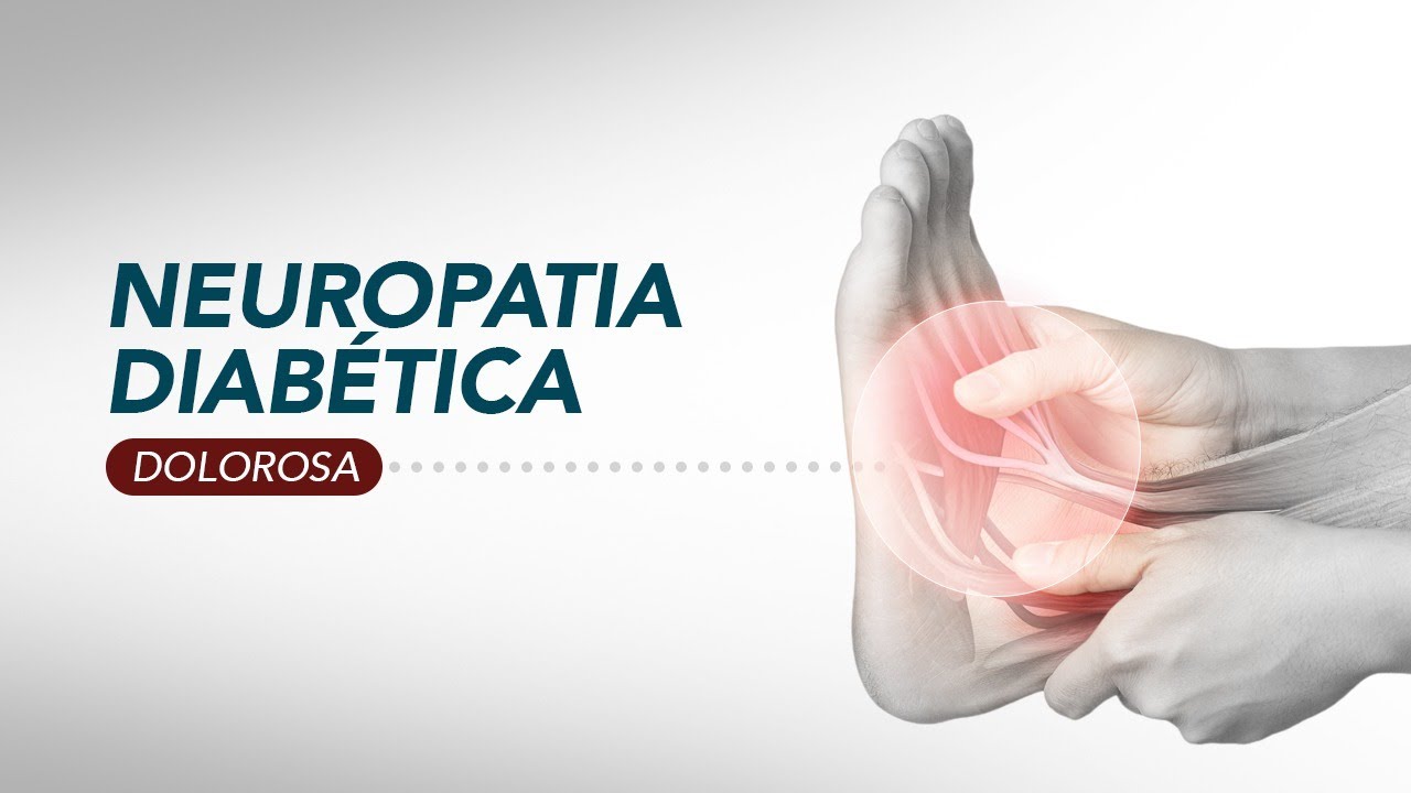 Tratamento da neuropatia diabética dolorosa