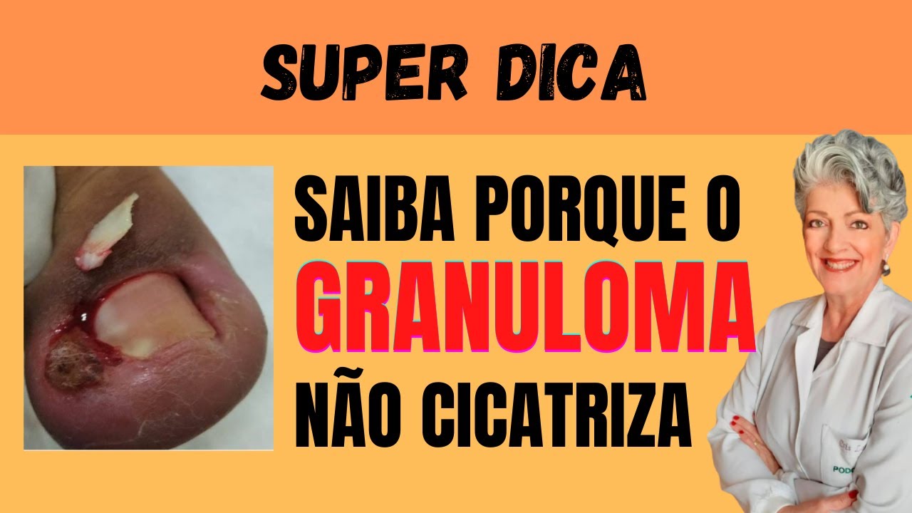 Porque o Granuloma Não Cicatriza