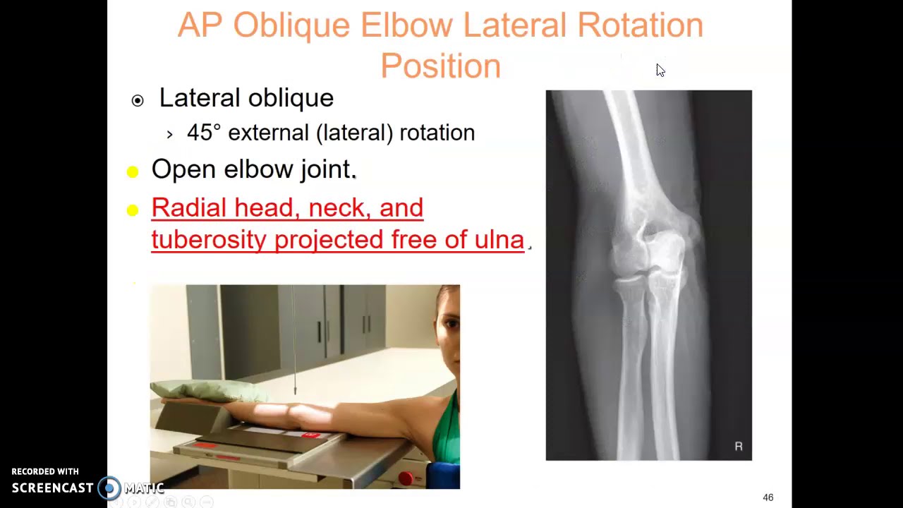 Elbow x-ray protocol