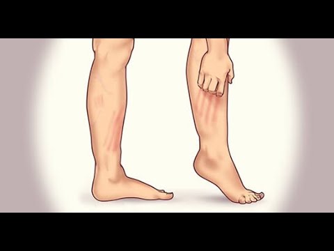 Cauzele rănilor la genunchi